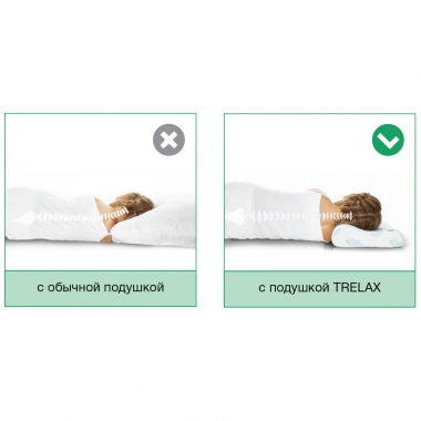 TRELAX 11361-001 Подушка ортопедическая TRELAX Respecta Baby П35, молочная